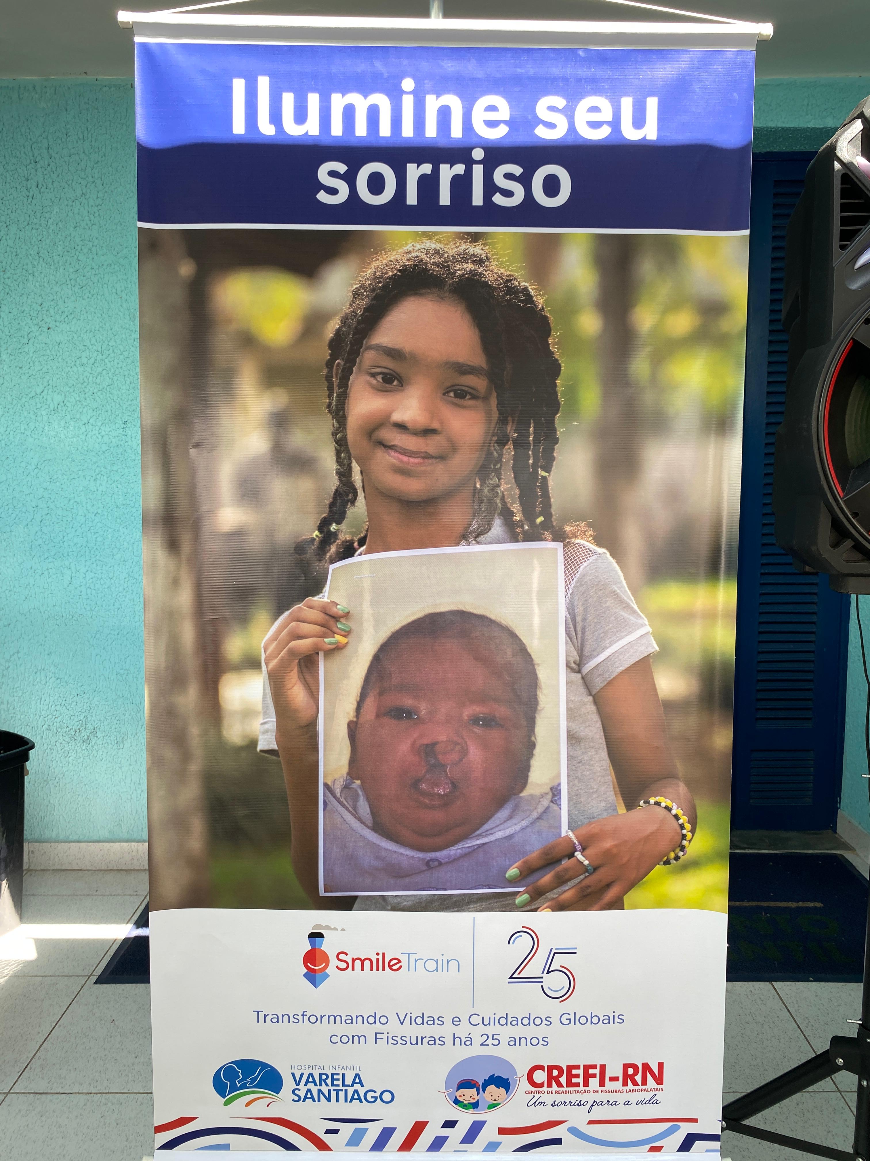 Smile Train Celebra 25 Anos com a Cleft Week 2024 no Hospital Infantil Varela Santiago